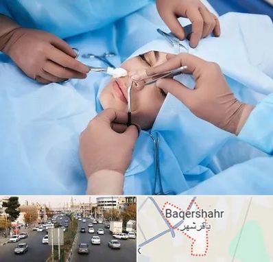 عمل بینی فانتزی در باقرشهر