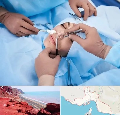 عمل بینی فانتزی در هرمزگان