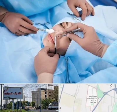 عمل بینی فانتزی در فاز یک اندیشه