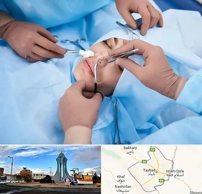 عمل بینی فانتزی در تایباد