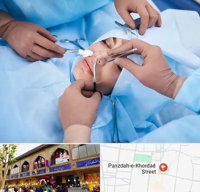 عمل بینی فانتزی در 15 خرداد