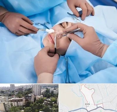 عمل بینی فانتزی در اوین