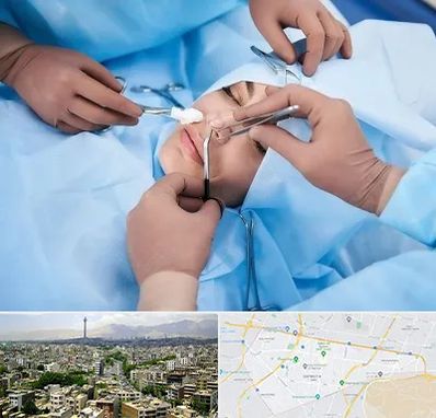 عمل بینی فانتزی در منطقه 8 تهران 