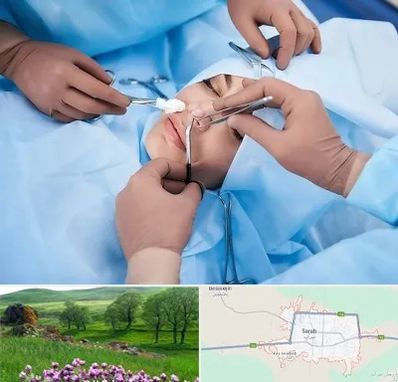 عمل بینی فانتزی در سراب