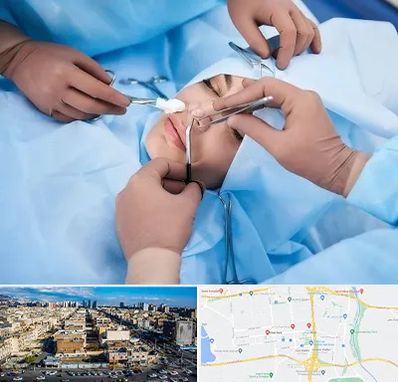 عمل بینی فانتزی در شهرک راه آهن