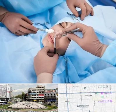 عمل بینی فانتزی در مرکز تهران