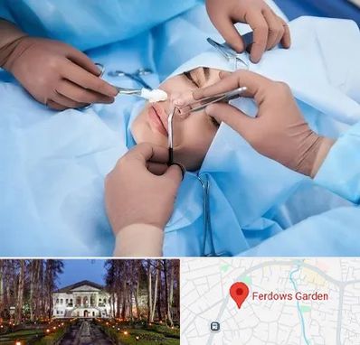 عمل بینی فانتزی در باغ فردوس