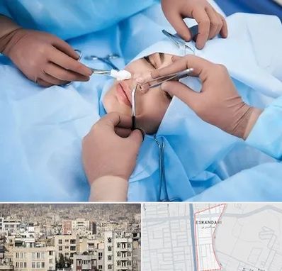 عمل بینی فانتزی در اسکندری