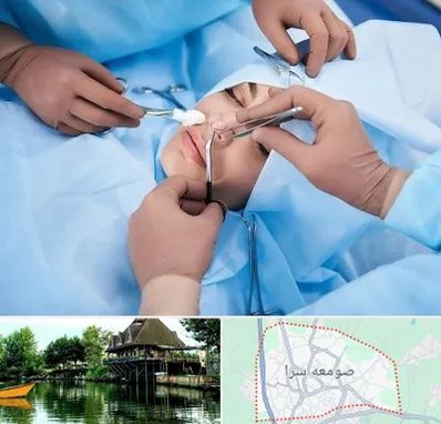 عمل بینی فانتزی در صومعه سرا