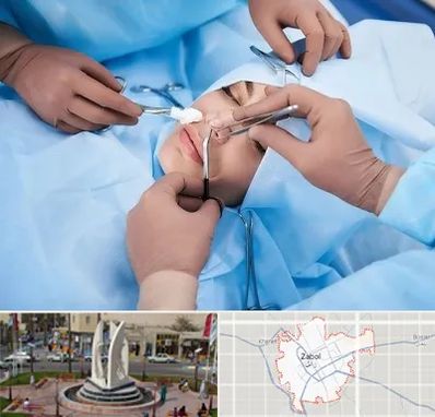 عمل بینی فانتزی در زابل