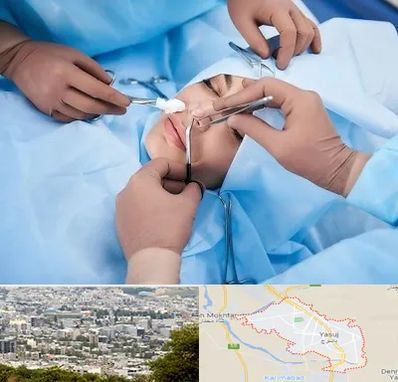 عمل بینی فانتزی در یاسوج