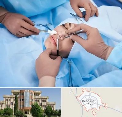 عمل بینی فانتزی در دهدشت