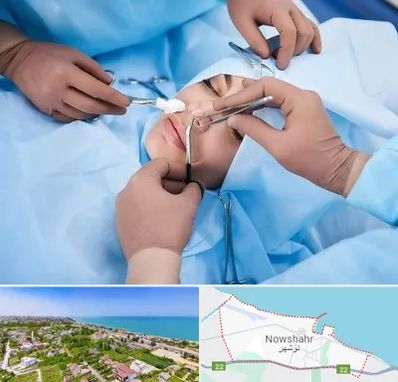 عمل بینی فانتزی در نوشهر