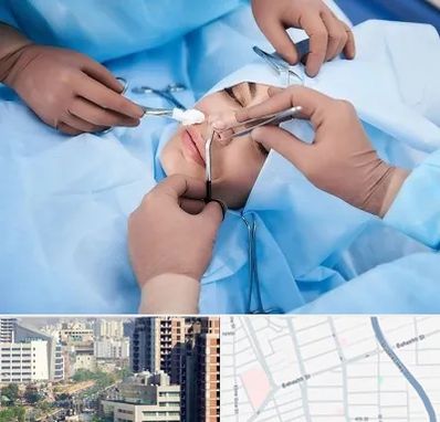 عمل بینی فانتزی در خیابان بهشتی