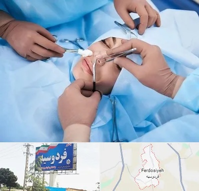 عمل بینی فانتزی در فردوسیه شهریار