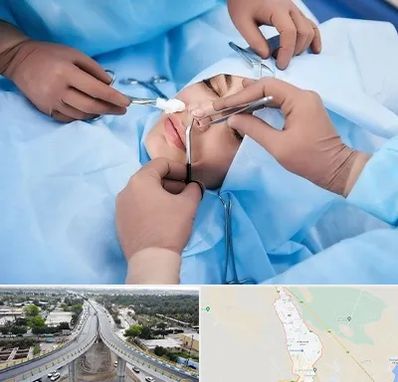 عمل بینی فانتزی در اندیمشک