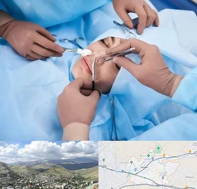 عمل بینی فانتزی در رودهن