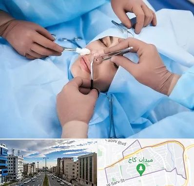 عمل بینی فانتزی در سعادت آباد 