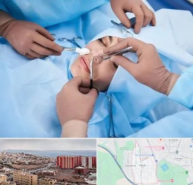 عمل بینی فانتزی در سهند تبریز