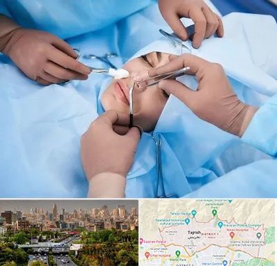 عمل بینی فانتزی در منطقه 1 تهران 