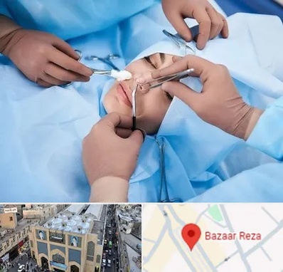 عمل بینی فانتزی در بازار رضا مشهد