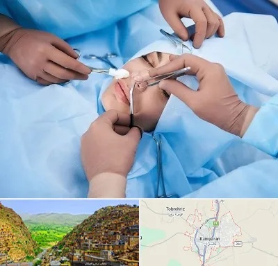 عمل بینی فانتزی در کامیاران