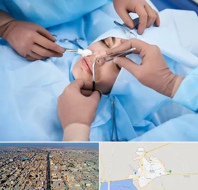 عمل بینی فانتزی در بندر ماهشهر