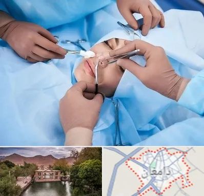 عمل بینی فانتزی در دامغان