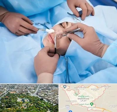 عمل بینی فانتزی در شهرکرد