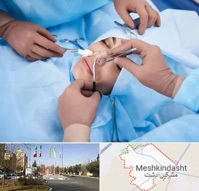 عمل بینی فانتزی در مشکین دشت