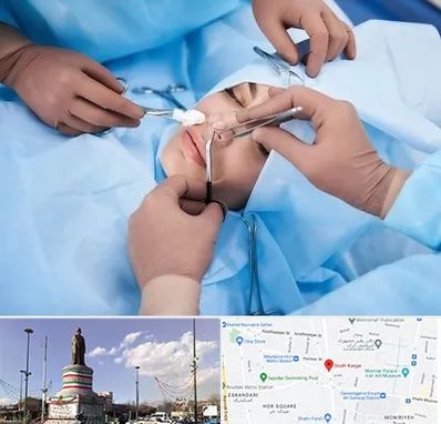 عمل بینی فانتزی در کارگر جنوبی 