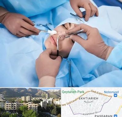 عمل بینی فانتزی در اختیاریه 