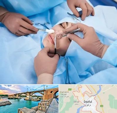 عمل بینی فانتزی در دزفول