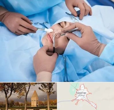عمل بینی فانتزی در تویسرکان