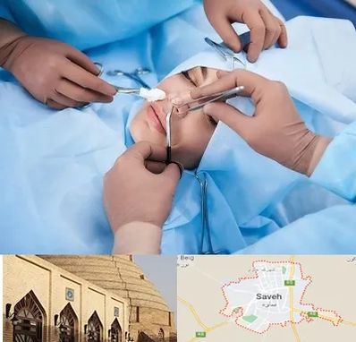 عمل بینی فانتزی در ساوه