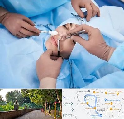 عمل بینی فانتزی در بلوار گیلان رشت