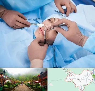 عمل بینی فانتزی در فومن