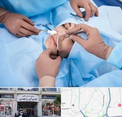 عمل بینی فانتزی در ایران زمین