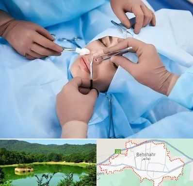 عمل بینی فانتزی در بهشهر