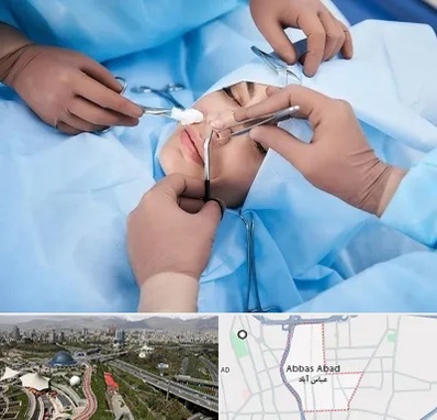 عمل بینی فانتزی در عباس آباد تهران