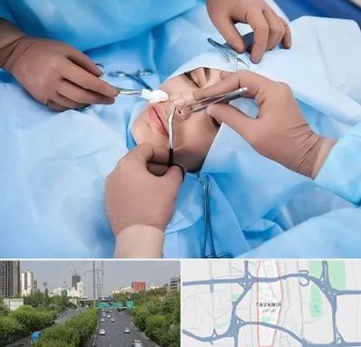 عمل بینی فانتزی در توانیر