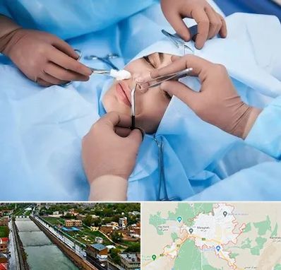 عمل بینی فانتزی در مراغه