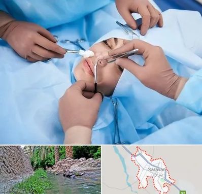 عمل بینی فانتزی در سراوان