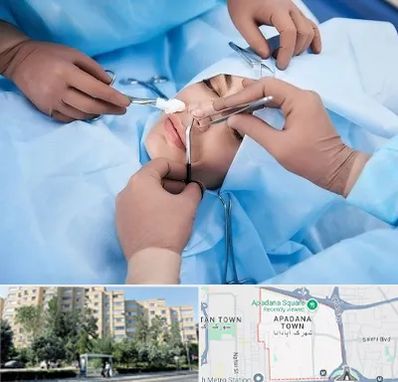 عمل بینی فانتزی در آپادانا