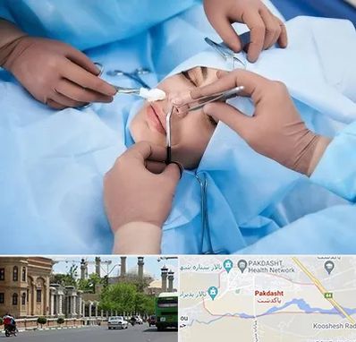 عمل بینی فانتزی در پاکدشت