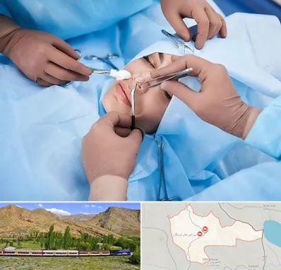 عمل بینی فانتزی در خاش