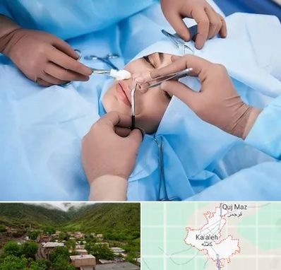 عمل بینی فانتزی در کلاله