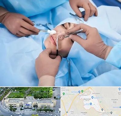 عمل بینی فانتزی در نسیم شهر