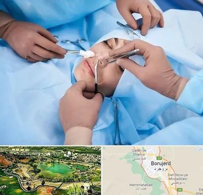 عمل بینی فانتزی در بروجرد