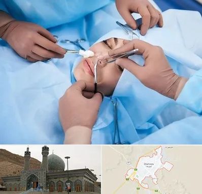 عمل بینی فانتزی در شهرضا